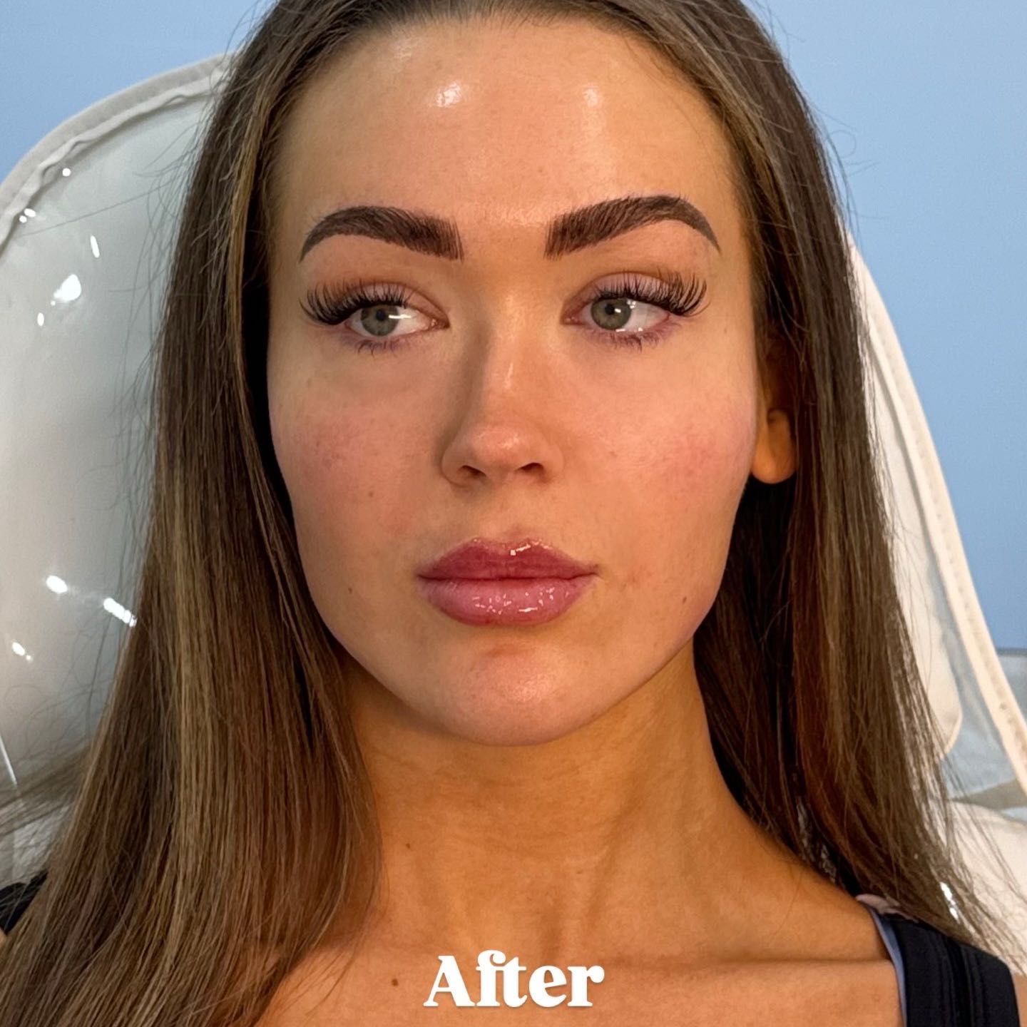 After treatment