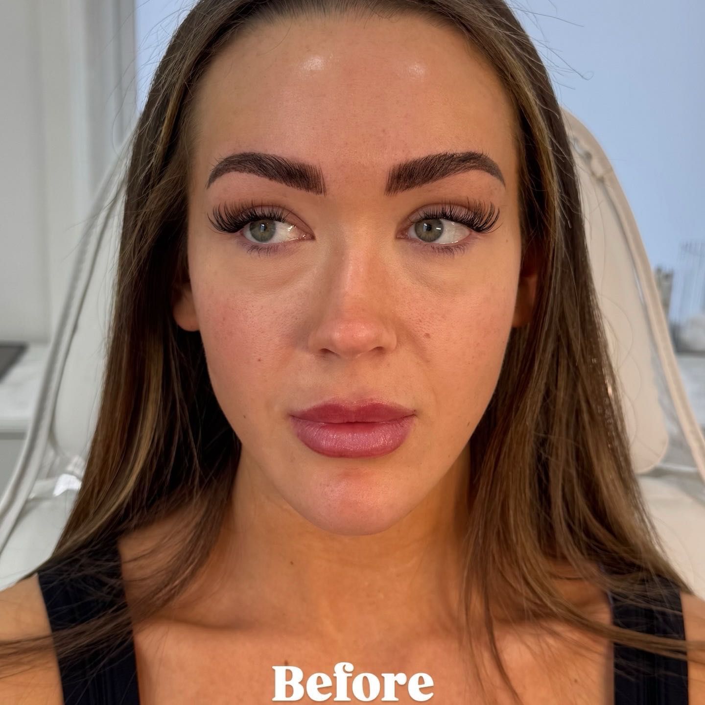 Before treatment